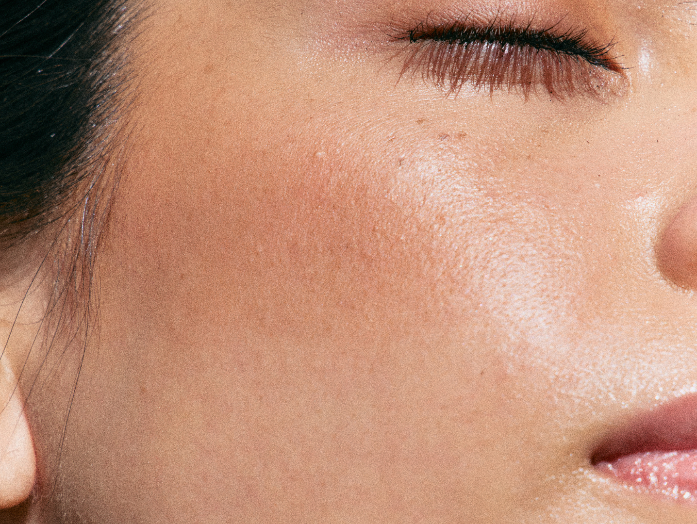 Oily and Congested Skin: Causes, Treatment and Skincare Routine
