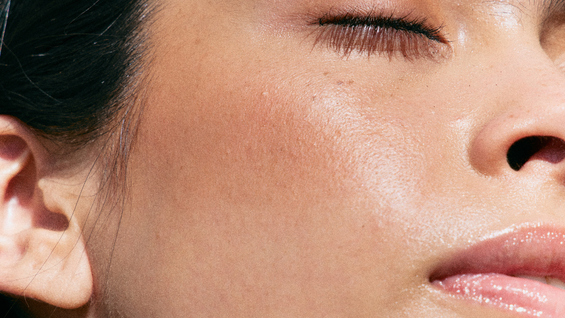 Oily and Congested Skin: Causes, Treatment and Skincare Routine